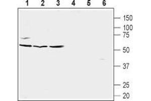 Western blot analysis of Burkitt's lymphoma (Raji) (lanes 1 and 4), human prostate carcinoma (LNCaP) (lanes 2 and 5) and human prostate carcinoma (PC-3) cell line lysates (lanes 3 and 6): - 1-3. (CXCR5 Antikörper  (Extracellular, N-Term))