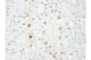 Immunohistochemistry (IHC) image for anti-Forkhead Box K1 (Foxk1) (AA 683-733) antibody (ABIN7448569) (Foxk1 Antikörper  (AA 683-733))
