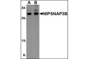 Western blot analysis of NIPSNAP3B in mouse brain tissue lysate with this product at (A) 1 and (B) 2 μg/ml. (NIPSNAP3B Antikörper  (Center))