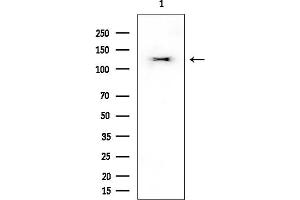 Western blot analysis of lysates from EC304 cells, using EPHA7 Mouse Monoclonal Antibody at 1/1000 dilution.