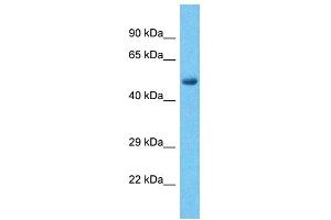 Host:  Rabbit  Target Name:  PHF15  Sample Type:  Liver Tumor lysates  Antibody Dilution:  1. (PHF15 Antikörper  (C-Term))