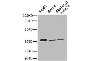 Western Blotting (WB) image for anti-Glyceraldehyde-3-Phosphate Dehydrogenase (GAPDH) (AA 3-105) antibody (ABIN2931072) (GAPDH Antikörper  (AA 3-105))