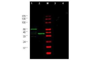 Western blot using  Affinity Purified anti-Yeast CHK1 antibody shows detection of a bands corresponding to CHK1 in Saccharomyces cerevisiae lysates. (CHEK1 Antikörper  (AA 312-327))