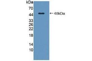 Detection of Recombinant C8g, Human using Polyclonal Antibody to Complement Component 8g (C8g) (C8G Antikörper  (AA 39-202))
