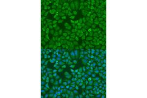 Immunofluorescence (IF) image for anti-Insulin-Like Growth Factor 2 mRNA Binding Protein 1 (IGF2BP1) (C-Term) antibody (ABIN3022057)