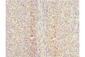 Immunohistochemistry of paraffin-embedded human tonsil tissue using ABIN7147293 at dilution of 1:100 (CDC7 Antikörper  (AA 275-574))