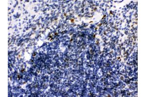 Anti- Ikaros Picoband antibody, IHC(P) IHC(P): Mouse Spleen Tissue (IKZF1 Antikörper  (C-Term))