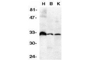 Western Blotting (WB) image for anti-Tumor Necrosis Factor Receptor Superfamily, Member 6b, Decoy (TNFRSF6B) (N-Term) antibody (ABIN2473237) (TNFRSF6B Antikörper  (N-Term))