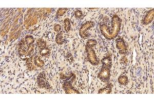 Immunohistochemistry (IHC) image for anti-TAR DNA Binding Protein (TARDBP) (AA 104-262) antibody (ABIN7434404)
