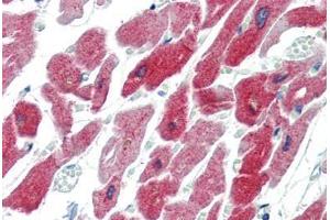 Human Heart (formalin-fixed, paraffin-embedded) stained with CRYAB antibody ABIN462098 at 10 µg/ml followed by biotinylated goat anti-rabbit IgG secondary antibody ABIN481713, alkaline phosphatase-streptavidin and chromogen. (CRYAB Antikörper)