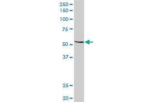 MGAT3 MaxPab rabbit polyclonal antibody. (MGAT3 Antikörper  (AA 1-533))