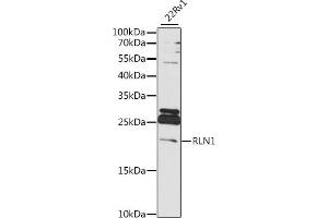 Western blot analysis of extracts of 22Rv1 cells, using RLN1 antibody (ABIN7269906) at 1:1000 dilution. (Relaxin 1 Antikörper  (AA 1-100))