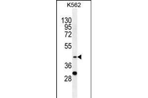 SERPINB4 Antikörper  (C-Term)