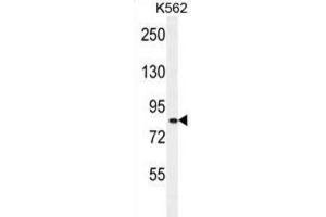 Western Blotting (WB) image for anti-Deafness, Autosomal Recessive 31 (DFNB31) antibody (ABIN2996024) (DFNB31 Antikörper)