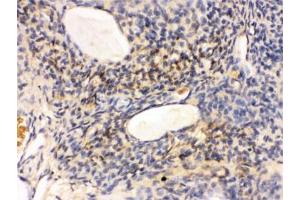 IHC testing of FFPE rat ovary tissue with GNAQ antibody. (GNAQ Antikörper)