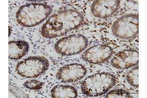 Immunostaining (ISt) image for anti-serum/glucocorticoid Regulated Kinase Family, Member 3 (SGK3) (AA 1-130) antibody (ABIN565148)