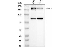 Western blot analysis of SBNO1 using anti-SBNO1 antibody (ABIN7601710). (SBNO1 Antikörper  (AA 43-1303))