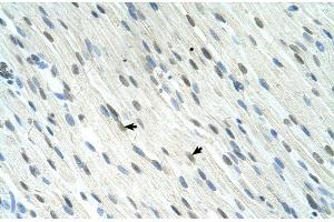 Human Muscle; SERTAD1 antibody - N-terminal region in Human Muscle cells using Immunohistochemistry (SERTAD1 Antikörper  (N-Term))