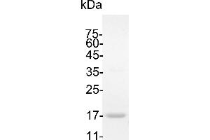 Interleukin 18 (IL18) (Active) protein (His tag)