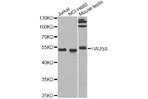 Western blot analysis of extracts of various cell lines, using HAUS8 antibody. (NYS48/HAUS8 Antikörper)
