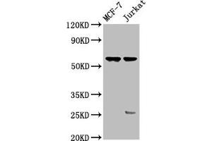 Western Blot Positive WB detected in: MCF-7 whole cell lysate, Jurkat whole cell lysate All lanes: STRA8 antibody at 3. (STRA8 Antikörper  (AA 115-241))