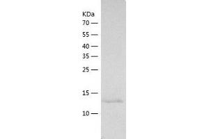 Western Blotting (WB) image for Zymogen Granule Protein 16 (ZG16) (AA 17-167) protein (His tag) (ABIN7284551) (ZG16 Protein (AA 17-167) (His tag))