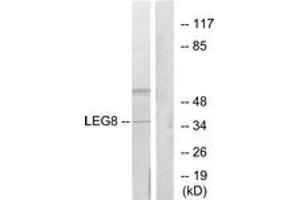 Western blot analysis of extracts from NIH-3T3 cells, using LEG8 Antibody. (LGALS8 Antikörper  (AA 61-110))