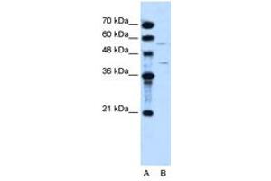 Image no. 1 for anti-Dihydroorotate Dehydrogenase (DHODH) (AA 112-161) antibody (ABIN204980) (DHODH Antikörper  (AA 112-161))