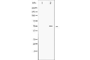 Western blot analysis of AML1 phosphorylation expression in Jurkat whole cell lysates,The lane on the left is treated with the antigen-specific peptide.