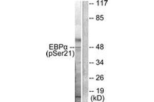 Western blot analysis of extracts from HepG2 cells treated with EGF 200ng/ml 5', using C/EBP-alpha (Phospho-Ser21) Antibody. (CEBPA Antikörper  (pSer21))