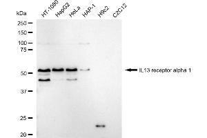 Western blotting analysis using IL13 receptor alpha 1 antibody (ABIN7799100). (Rekombinanter IL13 Receptor alpha 1 Antikörper)