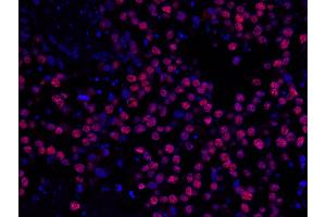 Immunofluorescence (IF) image for anti-Minichromosome Maintenance Complex Component 2 (MCM2) (AA 1-50) antibody (ABIN7448987) (MCM2 Antikörper  (AA 1-50))