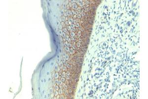 Formalin-fixed, paraffin-embedded human Skin stained with E-Cadherin Monoclonal Antibody (CDH1/1525).