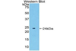Western Blotting (WB) image for anti-Macrophage Stimulating 1 Receptor (C-Met-Related tyrosine Kinase) (MST1R) (AA 89-275) antibody (ABIN1859892) (MST1R Antikörper  (AA 89-275))
