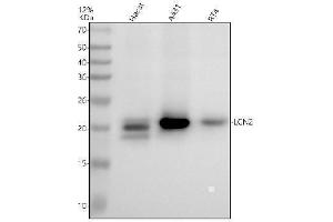 Western blot analysis of LCN2 using anti-LCN2 antibody (ABIN7605433).