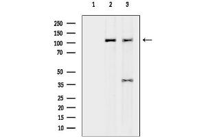 Western blot analysis of lysates from various samples, using DHX34 Antibody.