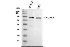 Western blot analysis of SLC5A4 using anti-SLC5A4 antibody (ABIN7602928).
