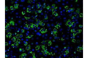 Image no. 2 for anti-Aconitase 2, Mitochondrial (ACO2) antibody (ABIN1496412) (ACO2 Antikörper)