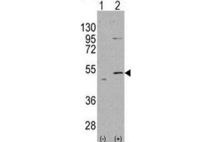 Western Blotting (WB) image for anti-Aldehyde Dehydrogenase 5 Family, Member A1 (ALDH5A1) antibody (ABIN2998188) (ALDH5A1 Antikörper)