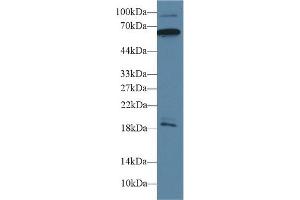 Detection of CAMK2g in Mouse Cerebrum lysate using Polyclonal Antibody to Calcium/Calmodulin Dependent Protein Kinase II Gamma (CAMK2g) (CAMKII gamma Antikörper  (AA 6-208))