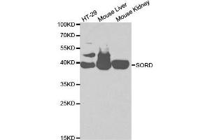 Western blot analysis of extracts of various cell lines, using SORD antibody. (SORD Antikörper  (AA 1-357))