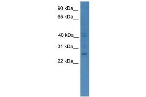 WB Suggested Anti-GCH1 Antibody Titration: 0. (GCH1 Antikörper  (C-Term))