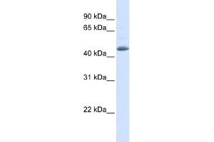 WB Suggested Anti-SNX5 Antibody Titration: 0. (SNX5 Antikörper  (N-Term))
