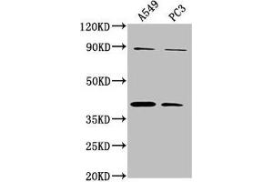 Western Blot Positive WB detected in: A549 whole cell lysate, PC3 whole cell lysate All lanes: ATP6V0D2 antibody at 1:2000 Secondary Goat polyclonal to rabbit IgG at 1/50000 dilution Predicted band size: 41 kDa Observed band size: 41 kDa (ATP6VD2 (AA 50-295) Antikörper)