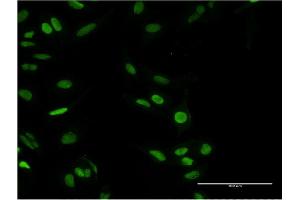 Immunofluorescence of monoclonal antibody to PARP1 on HeLa cell. (PARP1 Antikörper  (AA 1-100))