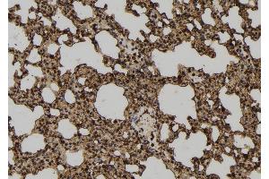 ABIN6277288 at 1/100 staining Mouse lung tissue by IHC-P. (Neural Wiskott-Aldrich syndrome protein (WASL) (Internal Region) Antikörper)
