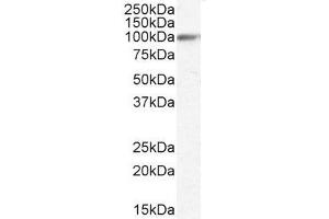 Western Blotting (WB) image for anti-Heat Shock Protein 90kDa beta (Grp94), Member 1 (HSP90B1) (Internal Region) antibody (ABIN185655)