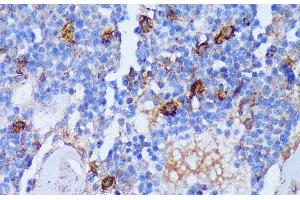 Immunohistochemistry of paraffin-embedded Rat bone marrow using PADI4 Polyclonal Antibody at dilution of 1:100 (40x lens). (PAD4 Antikörper)