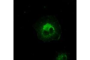 Image no. 6 for anti-Crystallin, alpha B (CRYAB) antibody (ABIN1497644) (CRYAB Antikörper)