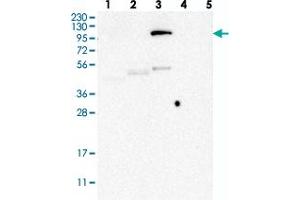 Western blot analysis of Lane 1: RT-4, Lane 2: U-251 MG, Lane 3: Human Plasma, Lane 4: Liver, Lane 5: Tonsil with LEMD3 polyclonal antibody . (LEMD3 Antikörper)